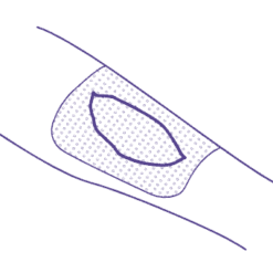 Membracel Membrana Regeneradora Porosa